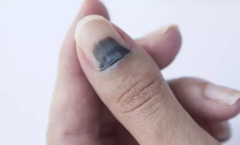 Рак, который видно сразу: на что обратить внимание