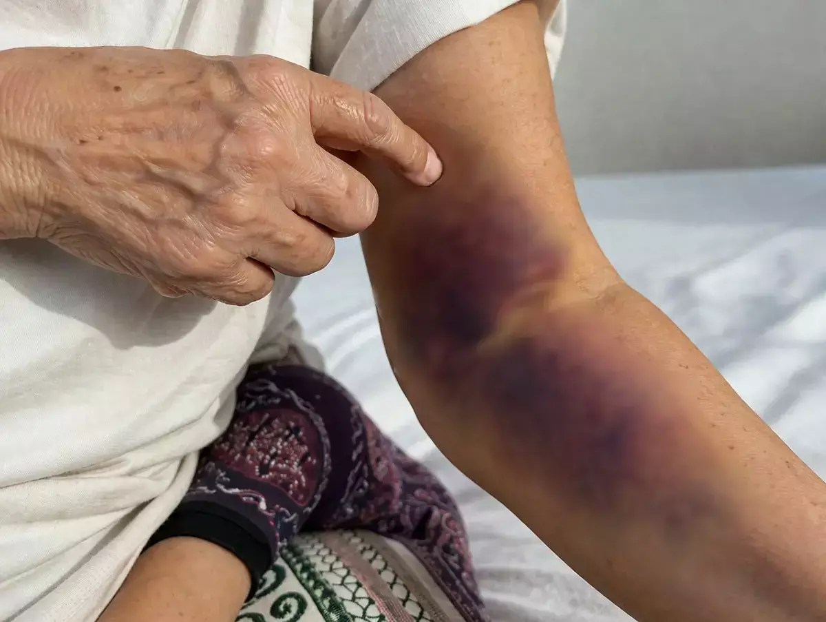 Одно лечат, другое калечат: после внутривенных инъекций у жительницы Актау не работает рука - новости на Lada.kz 29.03.2026