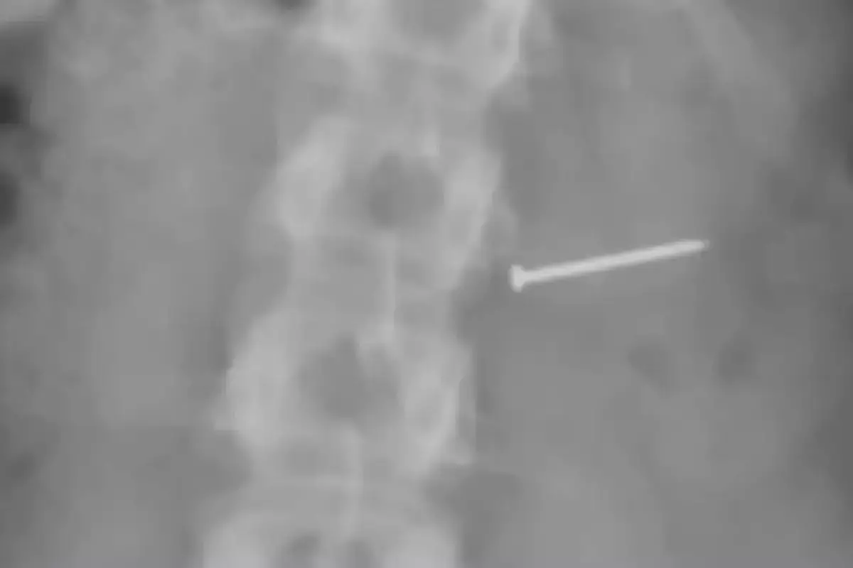 Женщина съела мороженое с гвоздями, стала бесплодной и получила $14 млн - новости на Lada.kz 29.03.2026