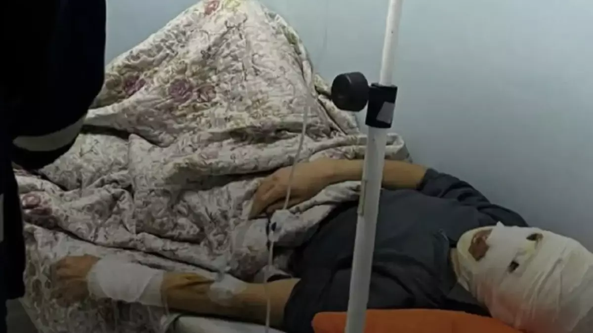 Маңғыстаудағы жанармай бекетінде ер адамды күйік шалды: Оқиғаға кім жауапты?