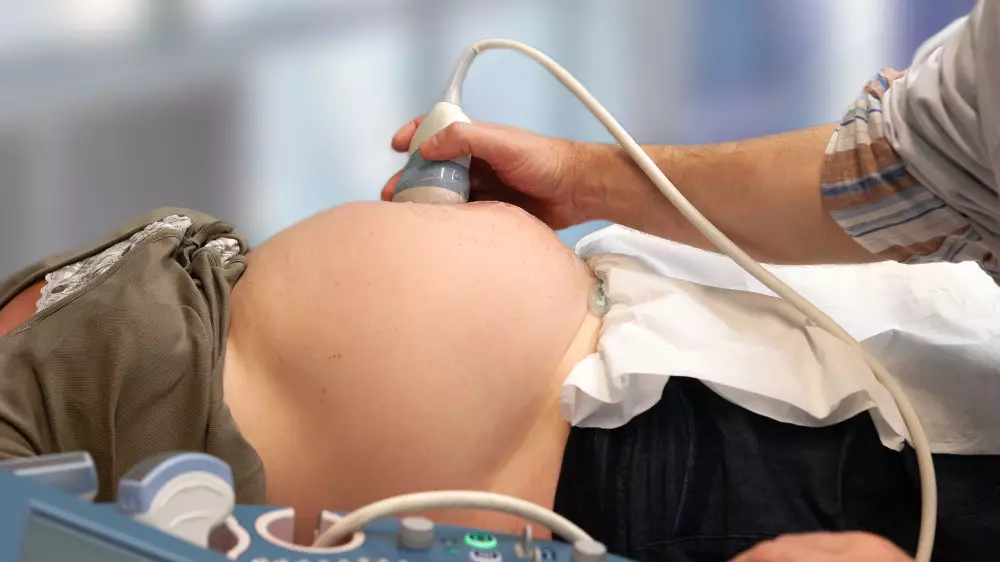 Астанада дәрігерлер 20 жастағы жас ананың жатырын алып тастаған: тергеу басталды