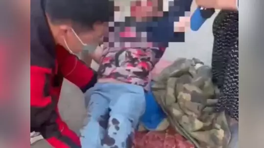 Алматы облысында мопедпен жүрген жасөспірім баланы қағып кетті