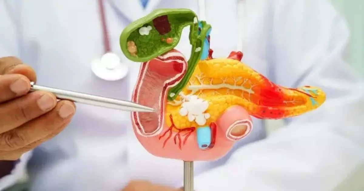  Жыл сайын ұйқы безі ісігінен 10 200 адам: дәрігер кеңесін біліңіз 