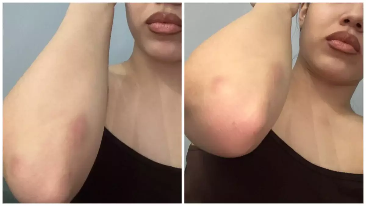 Хореограф из Астаны обвинила известного танцора в рукоприкладстве