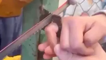 Қарағанды облысында футбол ойнап жүрген бала саусағынан айырыла жаздады