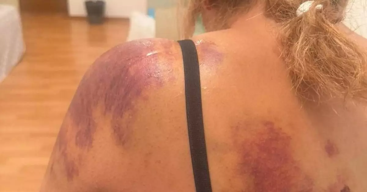  Жетісу облысында көршісін күрекпен ұрған күдікті бостандықта жүр 