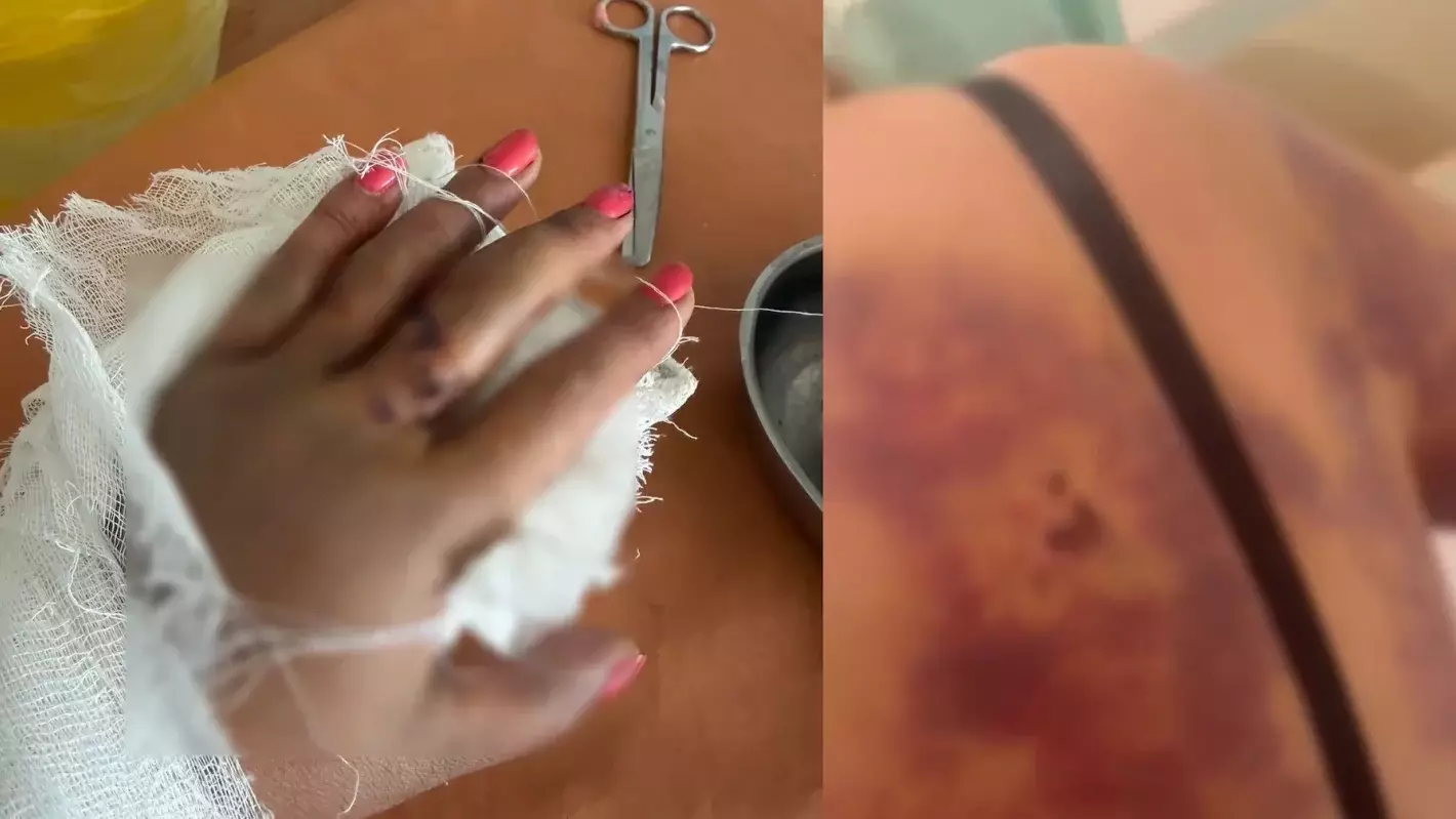 Мас ер адам дәрігерді күрекпен сабап, көкала қойдай етті