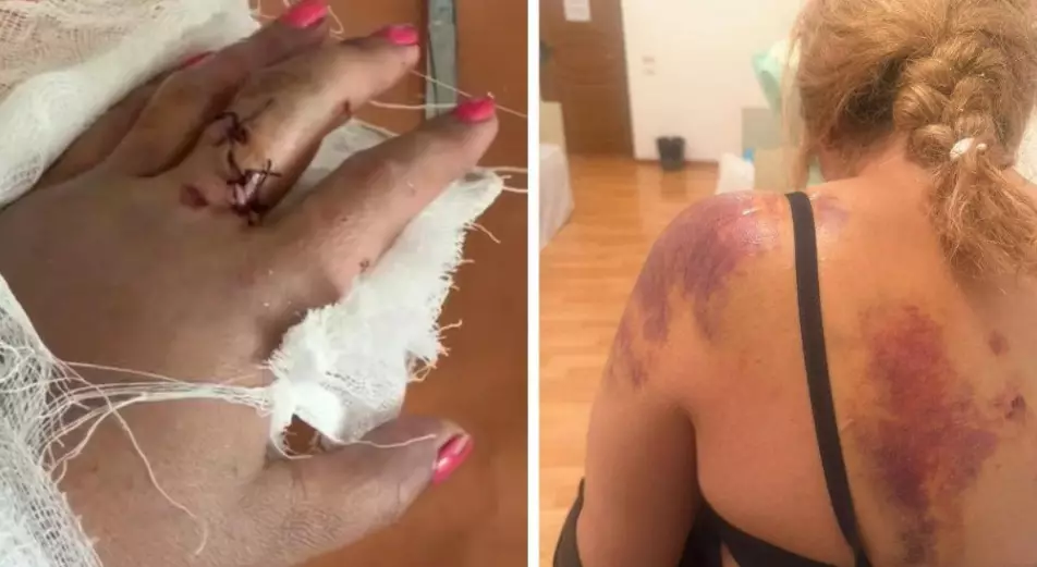 Жетісу облысында ер адам әйелді күрекпен аяусыз соққыға жықты