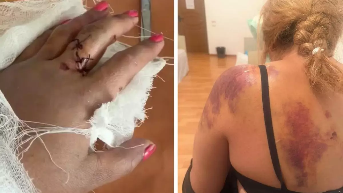 Жетісу облысында ер адам көрші әйелді күрекпен аяусыз ұрып тастаған