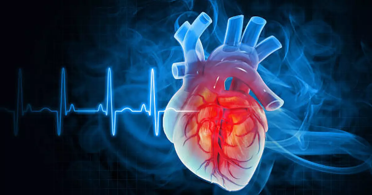   Қазақстанда инфаркт пен инсульттен өлім азайды   