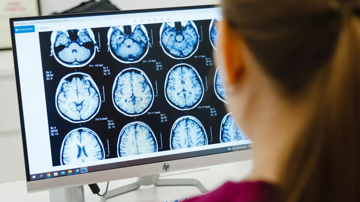 Паркинсон ауруы: «Дірілдеген сал» дерті туралы не білуіміз керек?