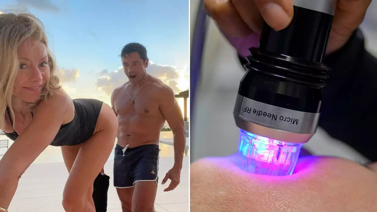 Что такое микроиглы для ягодиц: за "отчаянной" процедурой, которую попробовала Келли Рипа.