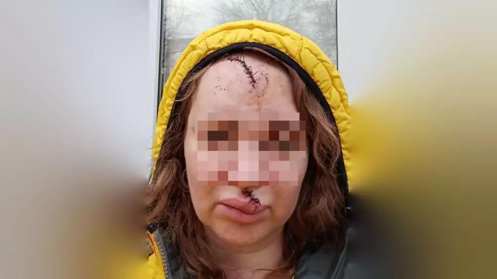 “Выбил зубы, изуродовал лицо“. Свидетельницу по уголовному делу жестоко избили в Петропавловске