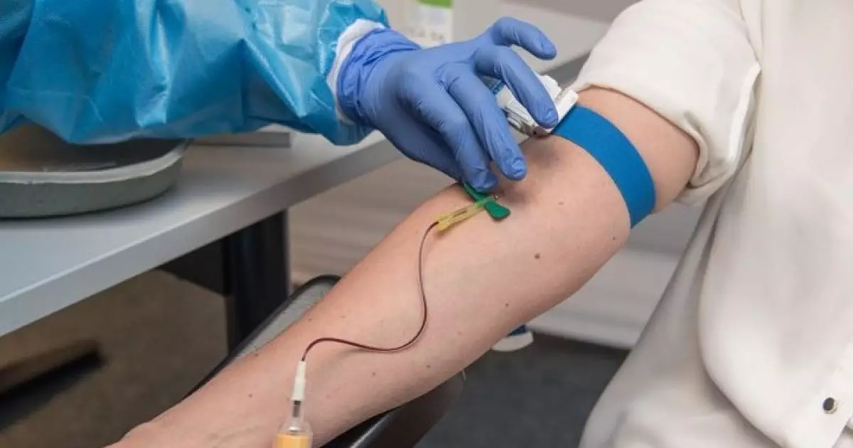  Қазақстанда донорларға төленетін өтемақы мардымсыз күйде қалды 