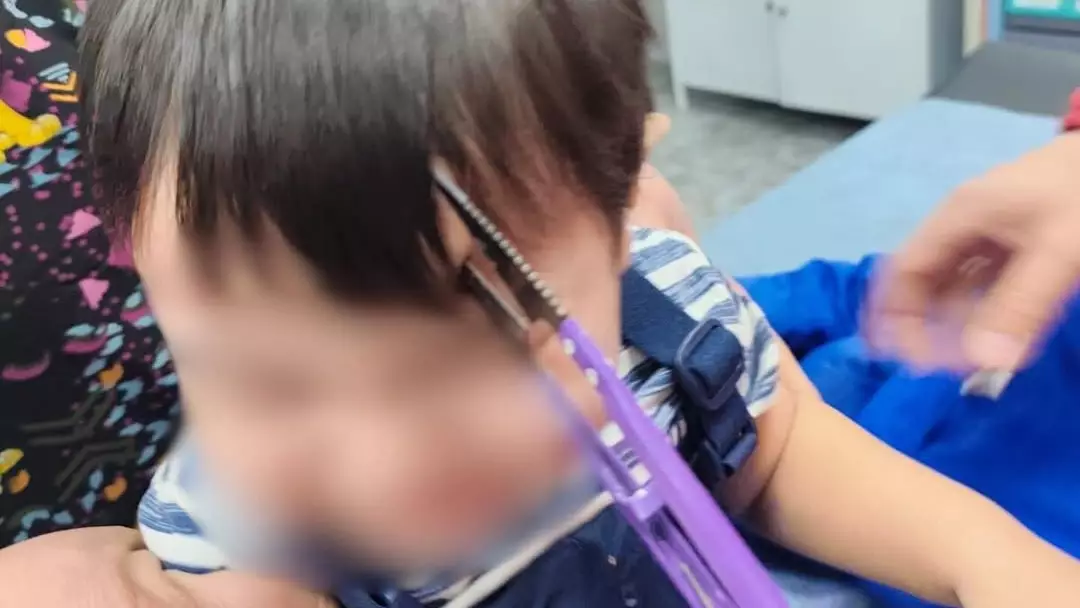 Алматыда дәрігерлер маңдайына қайшы қадалып қалған баланы құтқарды