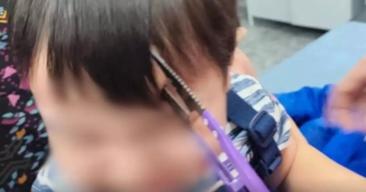  Алматылық дәрігерлер маңдайына қайшы қадалған баланы құтқарды 