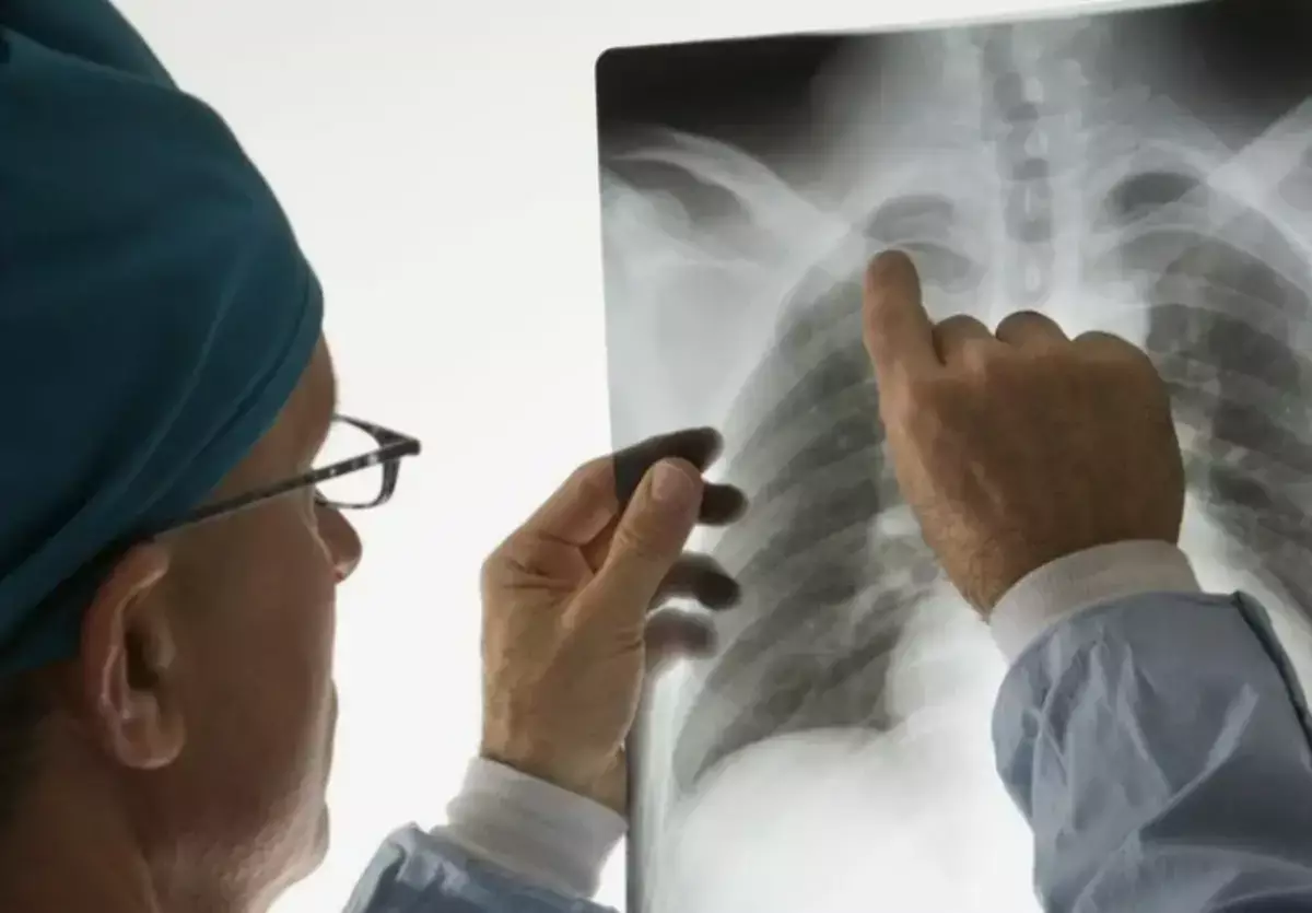 Врач объяснил, почему болезнь лёгких развивается не у всех курильщиков - новости на Lada.kz 14.04.2026