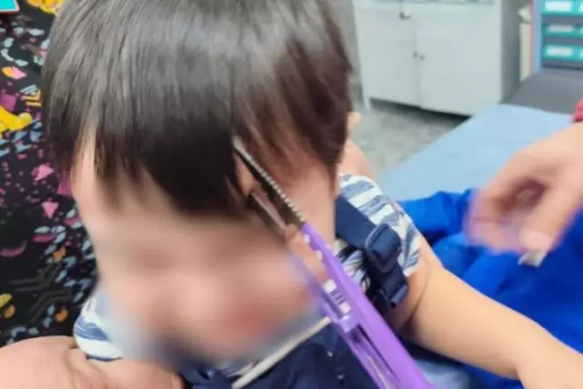 Алматыда бала ойнап жүріп маңдайын қайшымен тесіп алған