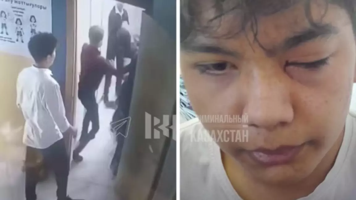 Тараз мектебінде жаға ұстатарлық жағдай: оқушы көзінен айырылып қала жаздады