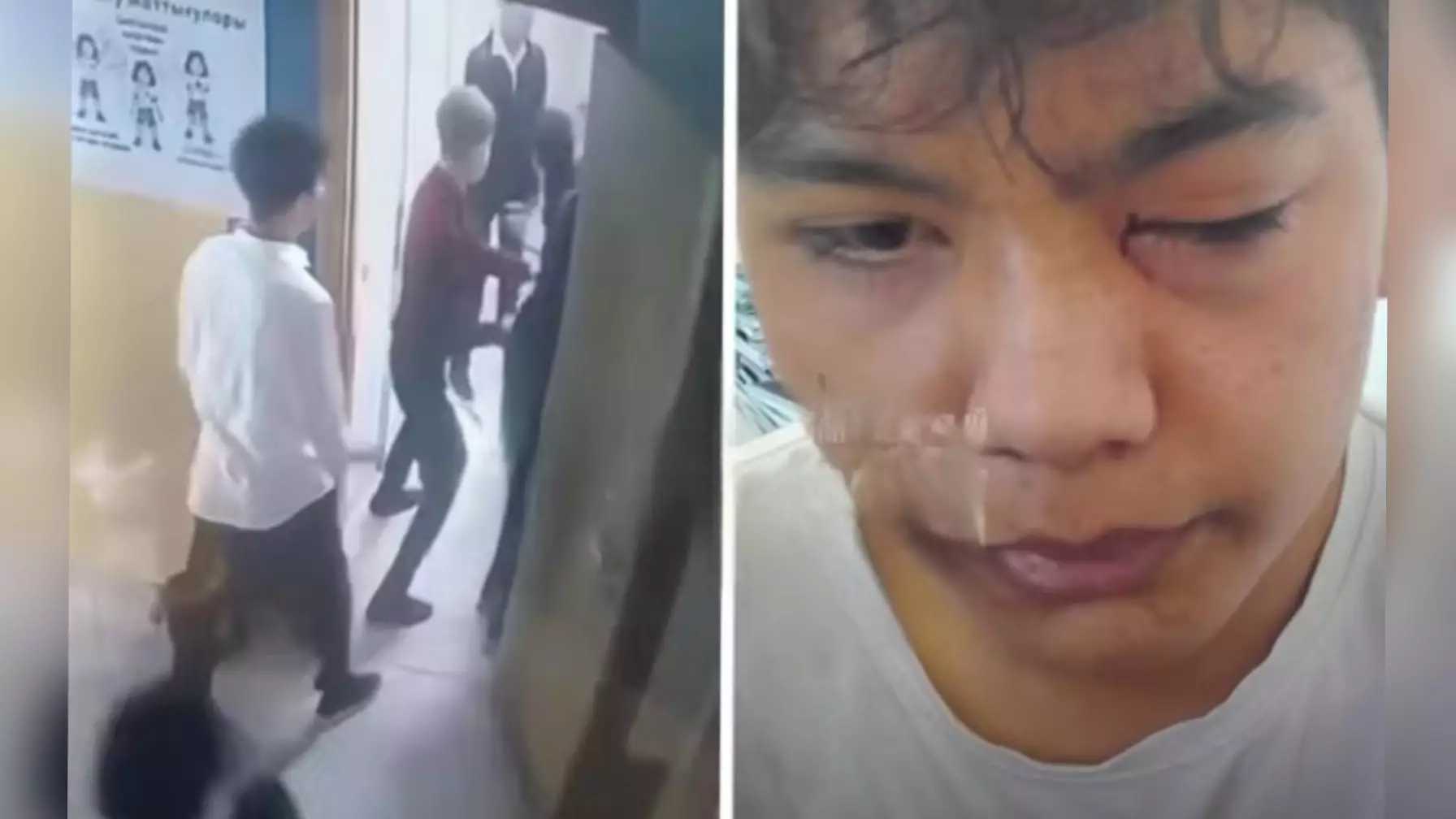 «Миы шайқалып, көз түбі толық зақымданған»: Тараздағы оқушылар төбелесі жайлы сұмдық ақпарат тарады (ВИДЕО)