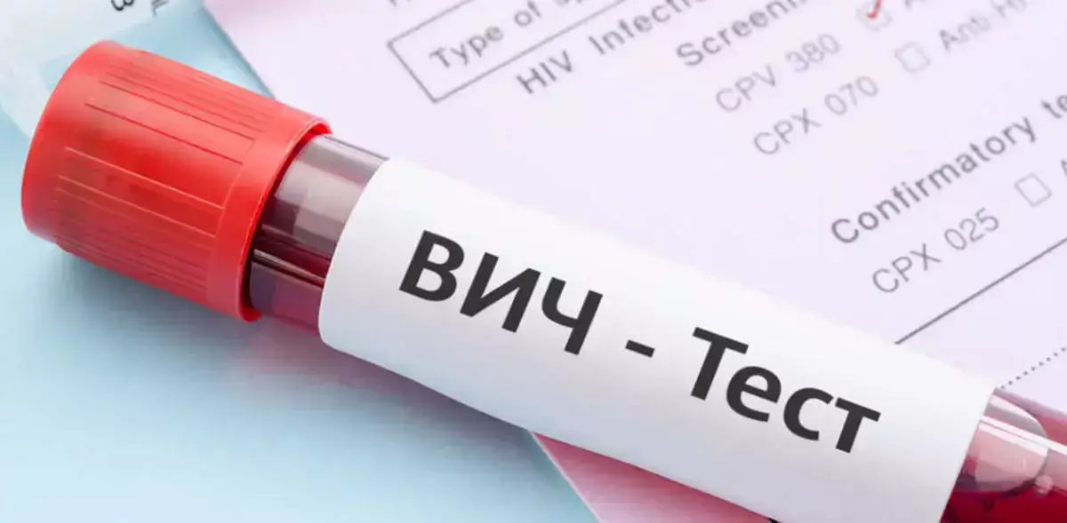 В Мангистау отмечается снижение случаев ВИЧ-инфекции - новости на Lada.kz 15.04.2026