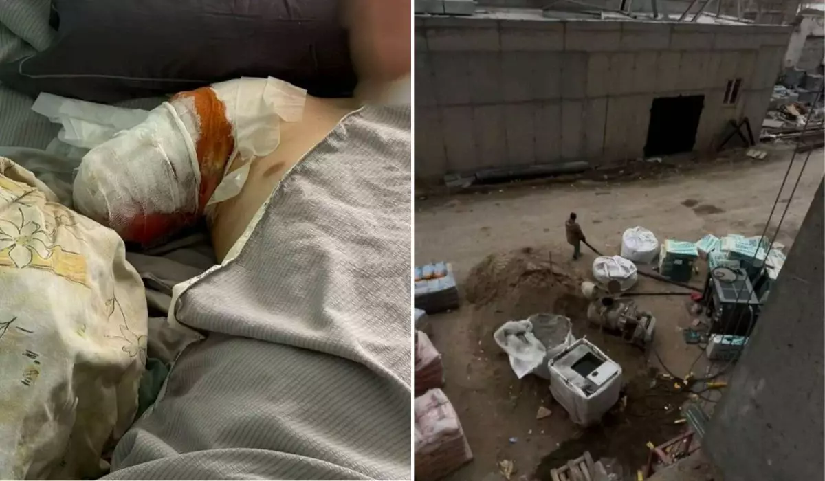 Қауіпсіздік талаптары сақталмаған: Семейде 20 жастағы құрылысшы жігіт қолынан айырылды