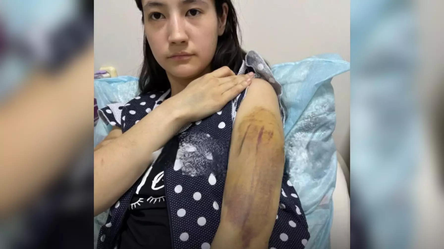 «Күйеуінің соққысы салдарынан көк бауырынан айырылды»: Қарағандыда адам шошырлық оқиға орын алды