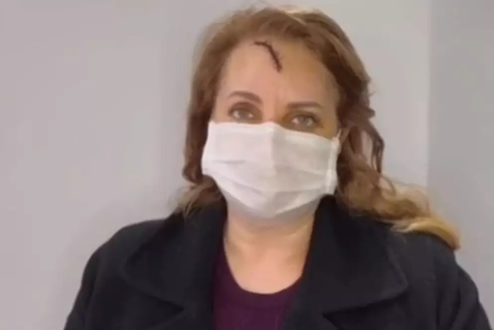 Петропавлда әйелдің жағын сындырған күдікті 1,5 жылдан бері табылмай жатыр