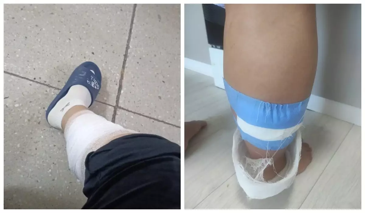 Көкшетауда бұралқы иттер жүкті әйелге шабуыл жасады