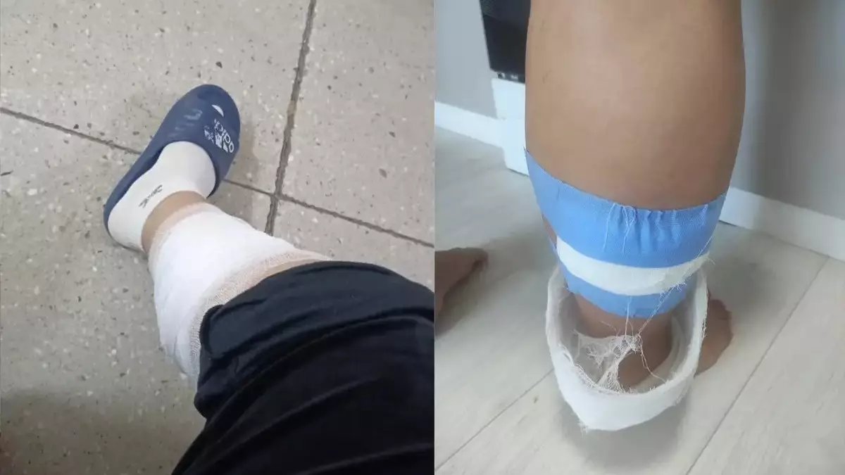 Көкшетауда аяғы ауыр әйелді бұралқы иттер қапқан: құрсақтағы сәбиге қалай әсер етеді?