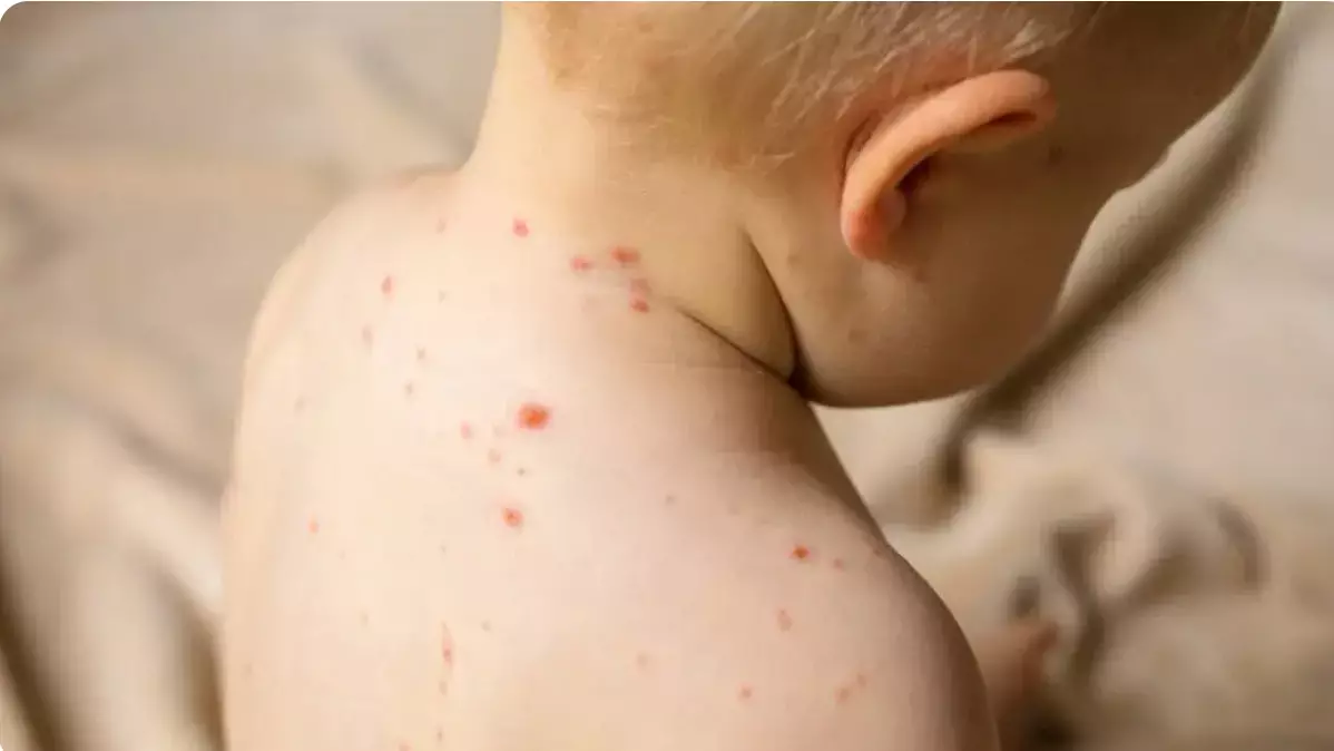 Қызылша бойынша ең қауіпті өңірлер анықталды