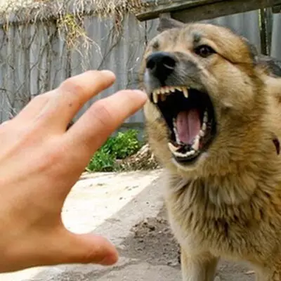 В Кокшетау беременную женщину покусала стая бродячих собак