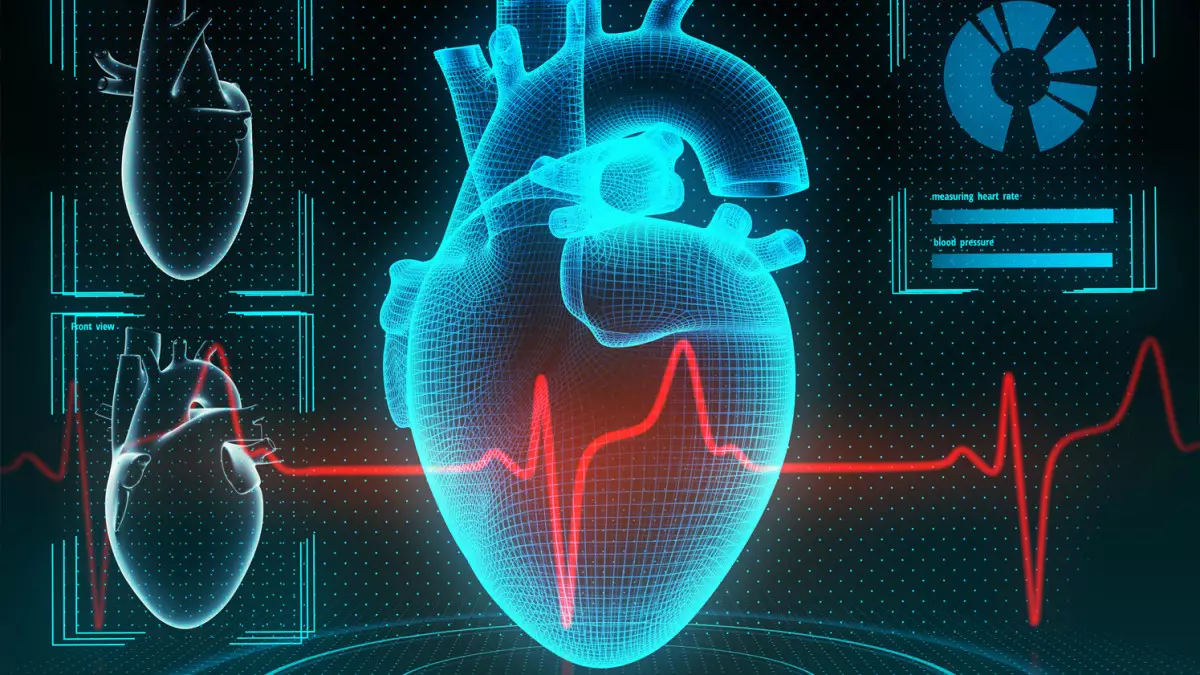 iCardy: новый стандарт кардиомониторинга без проводов, ограничений и лишнего дискомфорта