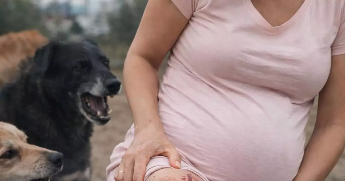  В Кокшетау бродячие собаки загрызли беременную 