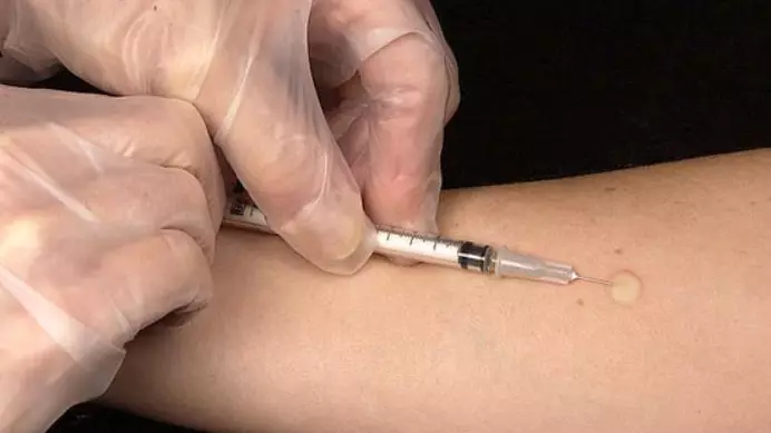 Қостанай облысында антибиотик қабылдаған 11 жастағы қыз мүгедек болып қалды