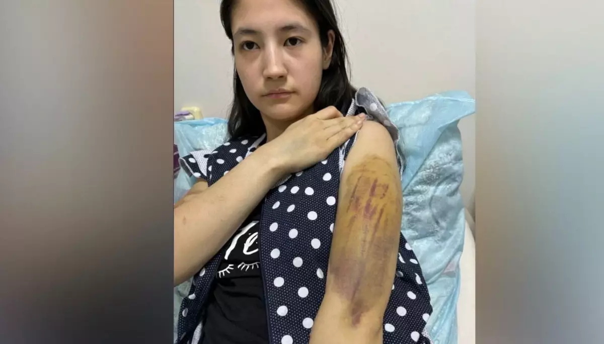 "Ұрып-соғып, қайнаған суға шомылдырды": 19 жастағы қыз төрт жыл бойы күйеуінен зәбір көріп келген