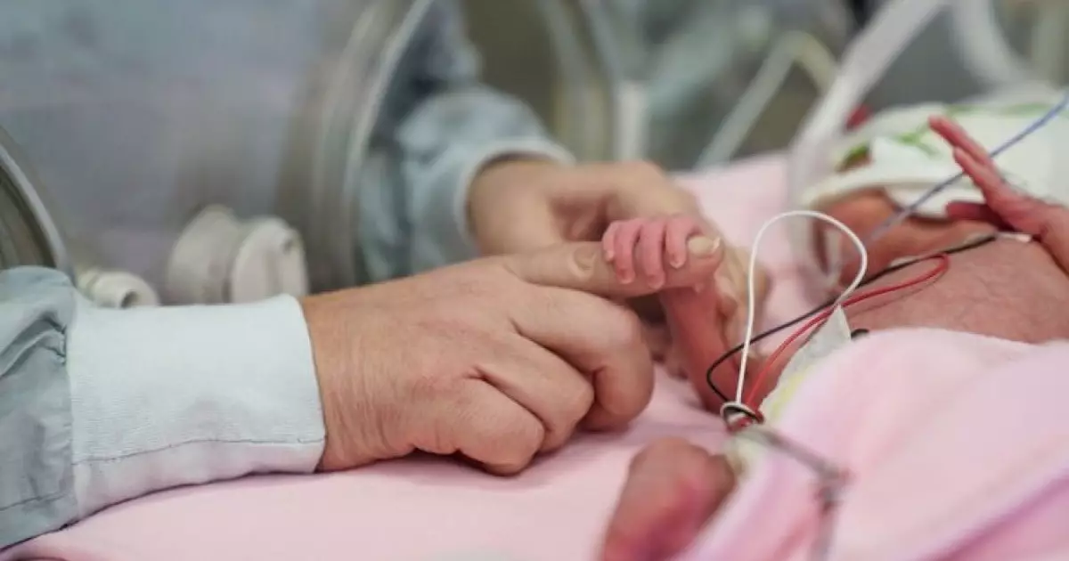  Салмағы 400 грамм болып туған сәби 129 күн жансақтау бөлімінде болды 