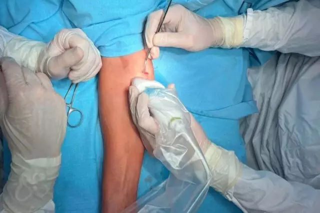 Ер адам тіс дәрігеріне барғаннан кейін қолы мен аяғынан айырылды