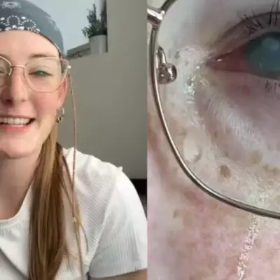 Безобидный душ в линзах чуть не лишил глаза 20-летнюю девушку