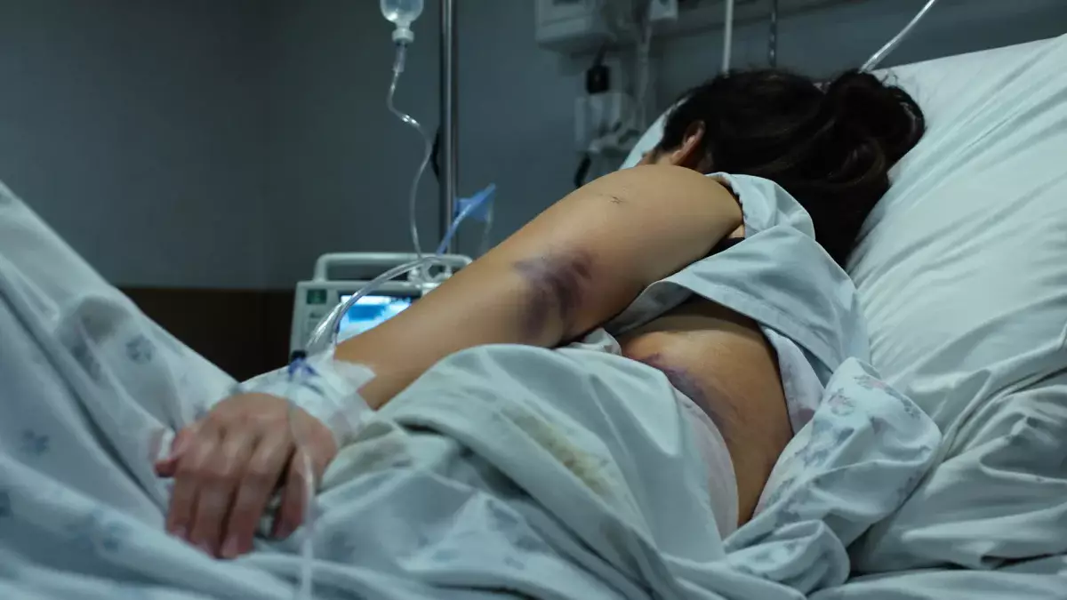 «Бил трубой и обливал кипятком»: 19-летняя карагандинка лишилась органа после пыток мужа