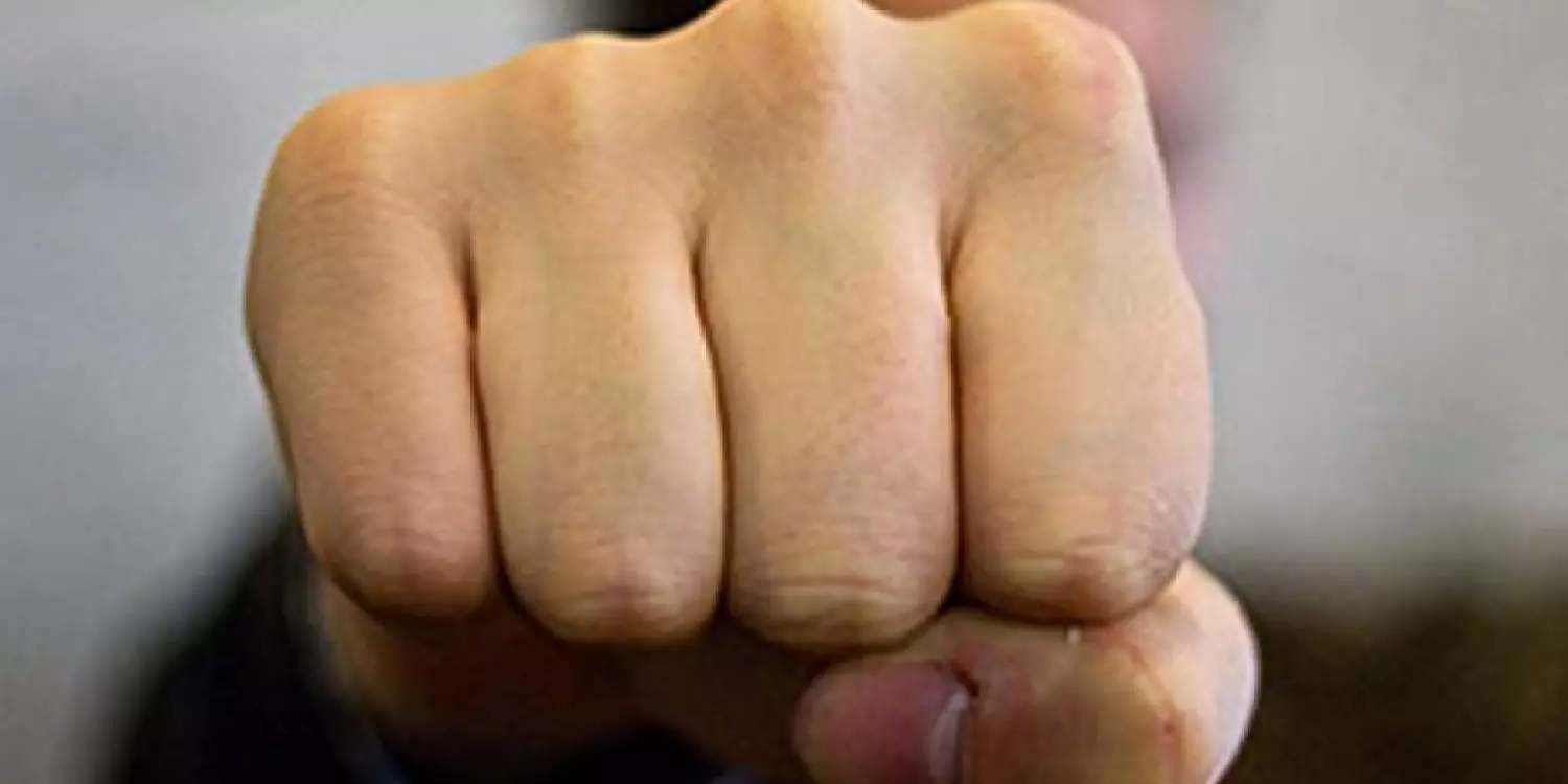  «Жақ сүйегі мен мұрны сынған»: Абай облысында шекарашы соққыға жығылған