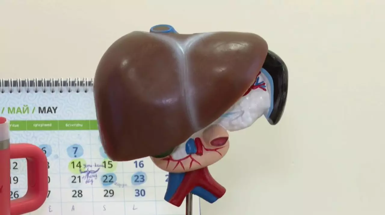 Около шести тысяч казахстанцев в год умирают от цирроза печени