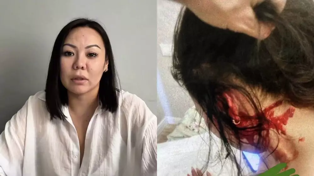 Ұрып-соғып, “ІІМ-дегі туыстарымен” қорқытқан: алматылық әйел өзін сталкерден қорғауды сұрады