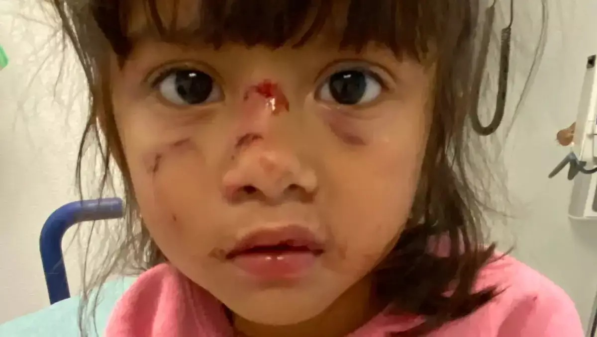 Мигрант напал на трехлетнюю девочку и вырвал ей зубы на глазах у матери - новости на Lada.kz 28.04.2026