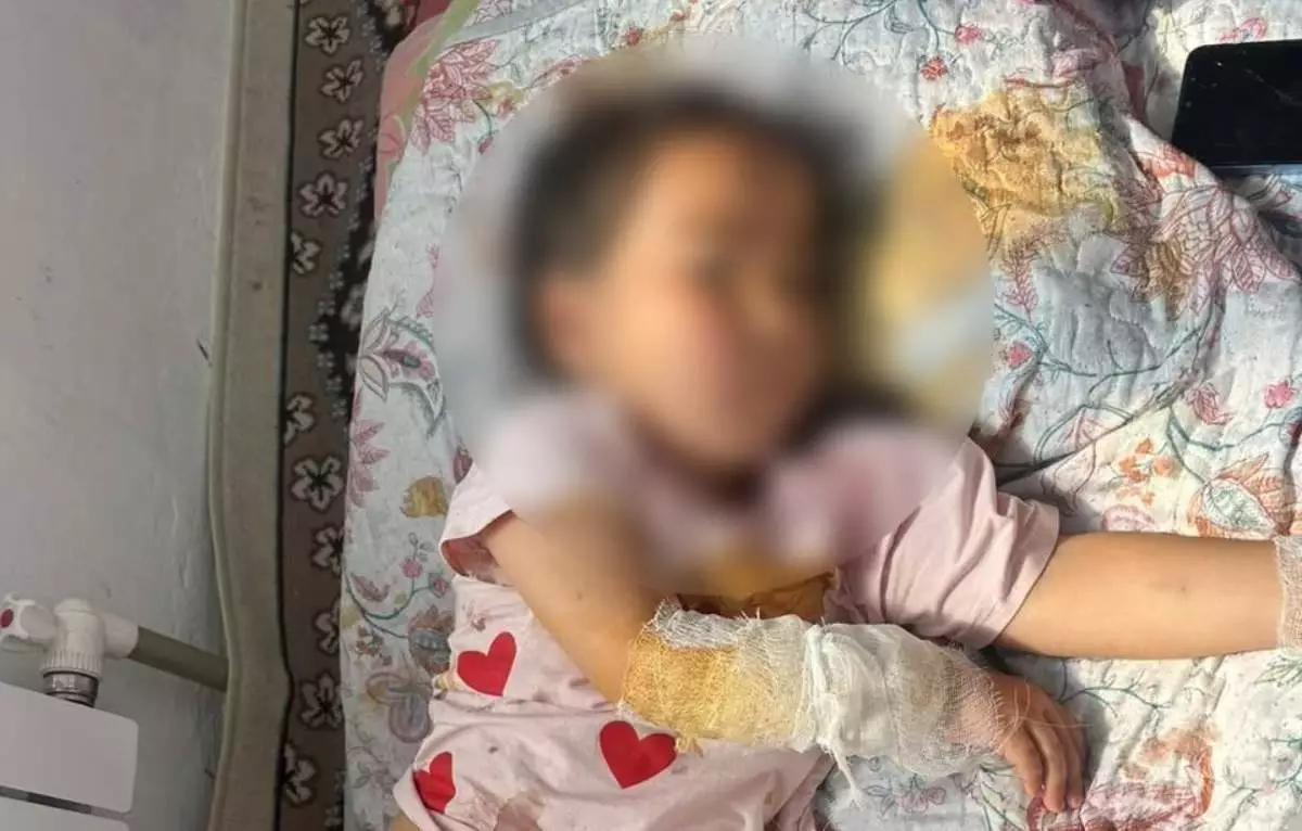 Түркістан облысында 4 жасар қызды шибөрі талаған