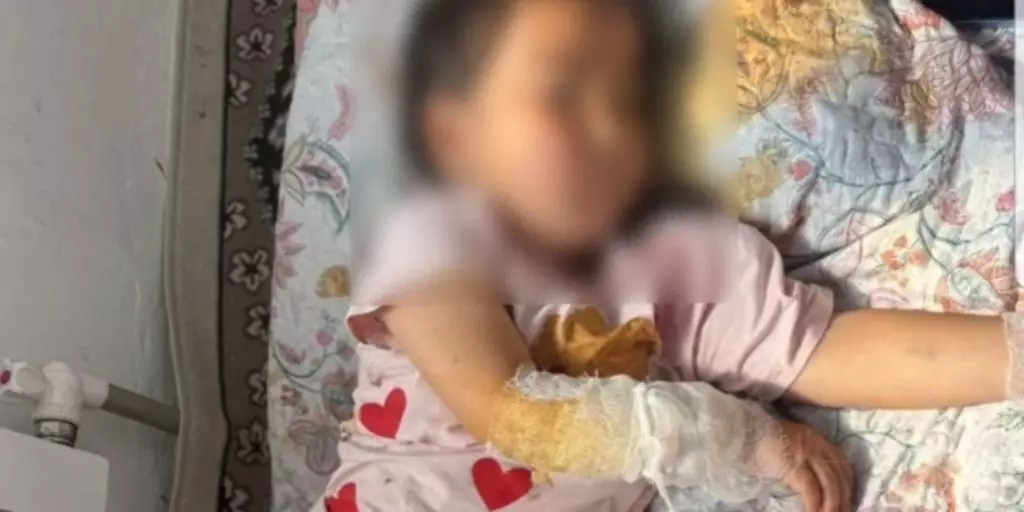 Дикий шакал напал на 4-летнюю девочку в Туркестанской области