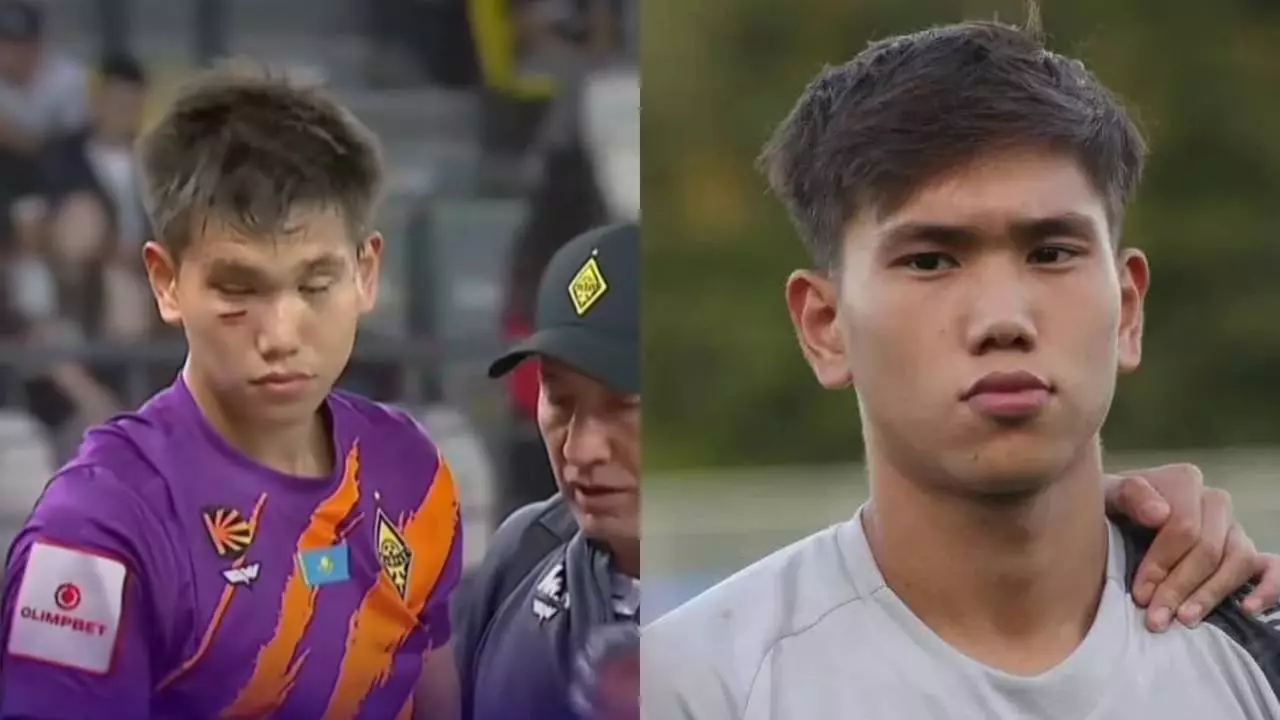 "Бетінен тепкен": Қақпашы Шерхан Қалмұрза сұмдық жарақат алды (ВИДЕО)