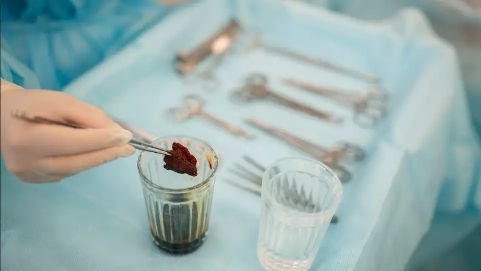 ШҚО-да үйде сүндеттелген бірнеше бала ауруханаға түсті