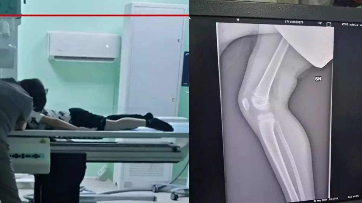 «Аяқтары көгерген… Артыңа ағаш тығамыз»: Степногорскте бір топ бала жабылып, 1-сынып оқушысын ұрып кетті