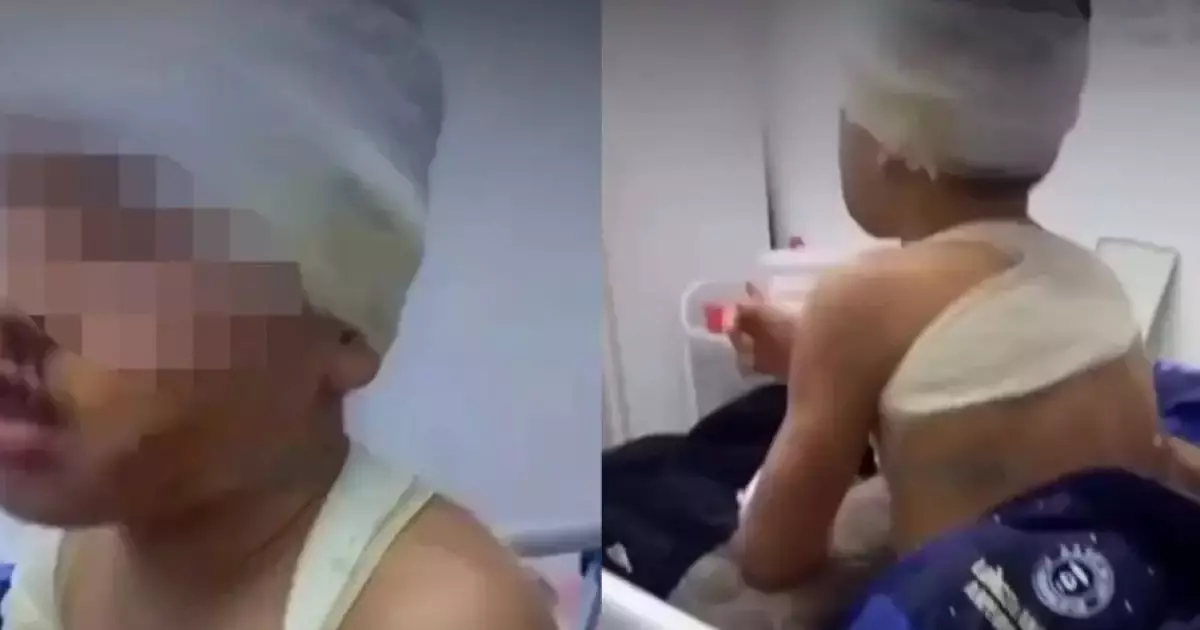  Шымкентте әйел адам шанышқыны газға қыздырып, туған баласының аузын күйдірген (ВИДЕО) 